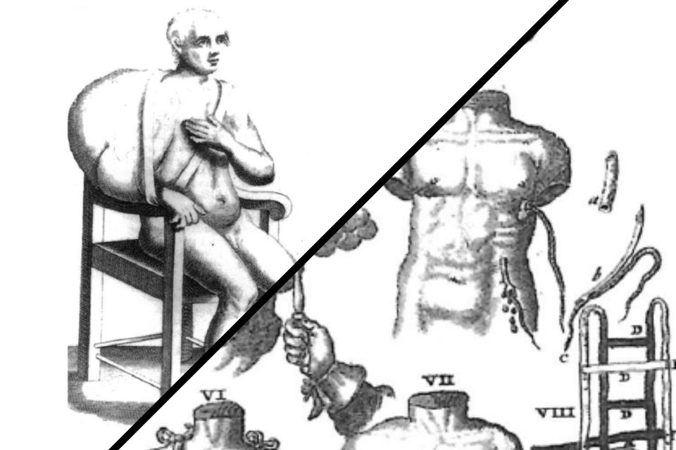 cancro, 600, illustrazioni, chirurgia,