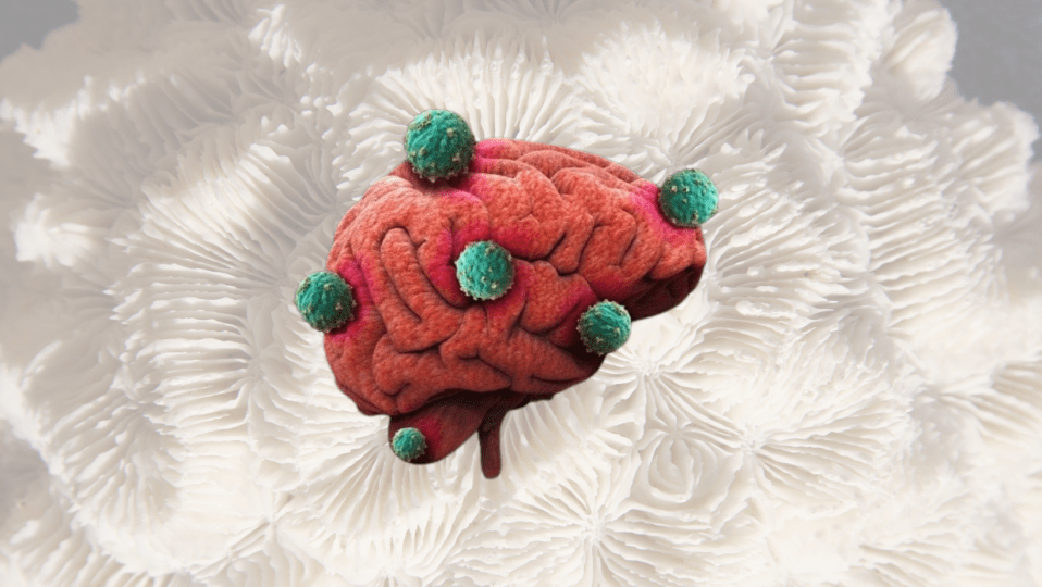 glioblastoma, cura glioblastoma, fondazione bartolo longo